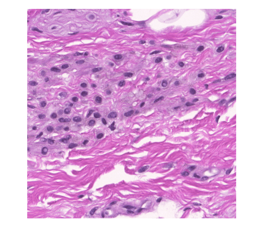 Example whole slide image